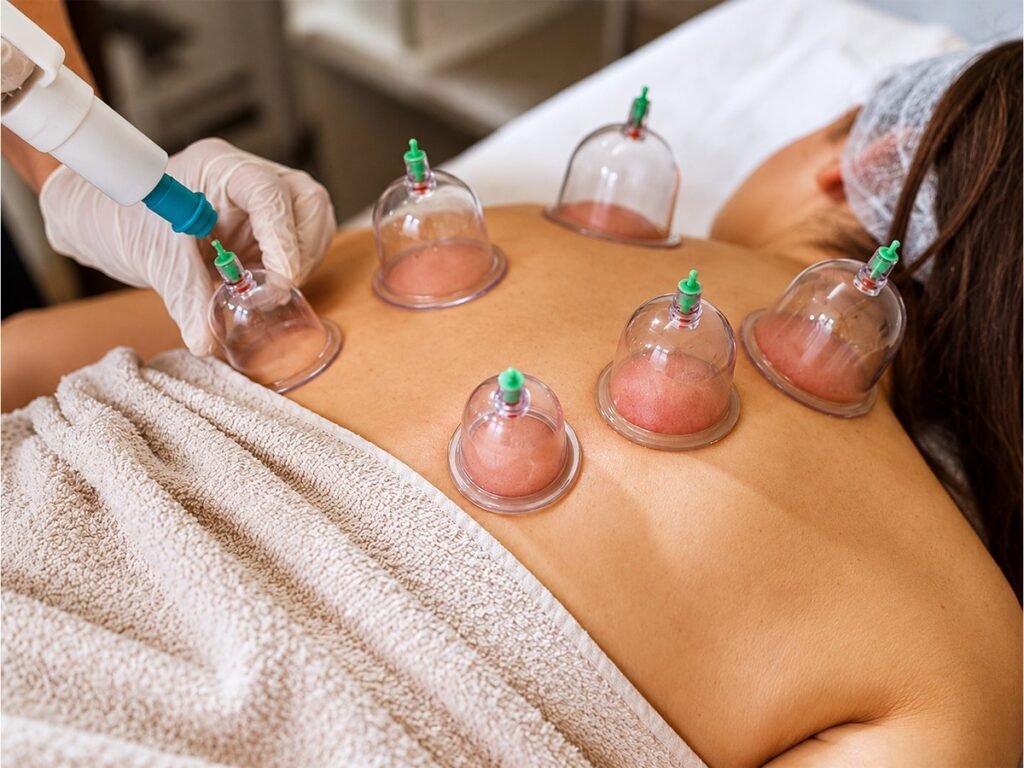 Cupping therapy on a patient’s back